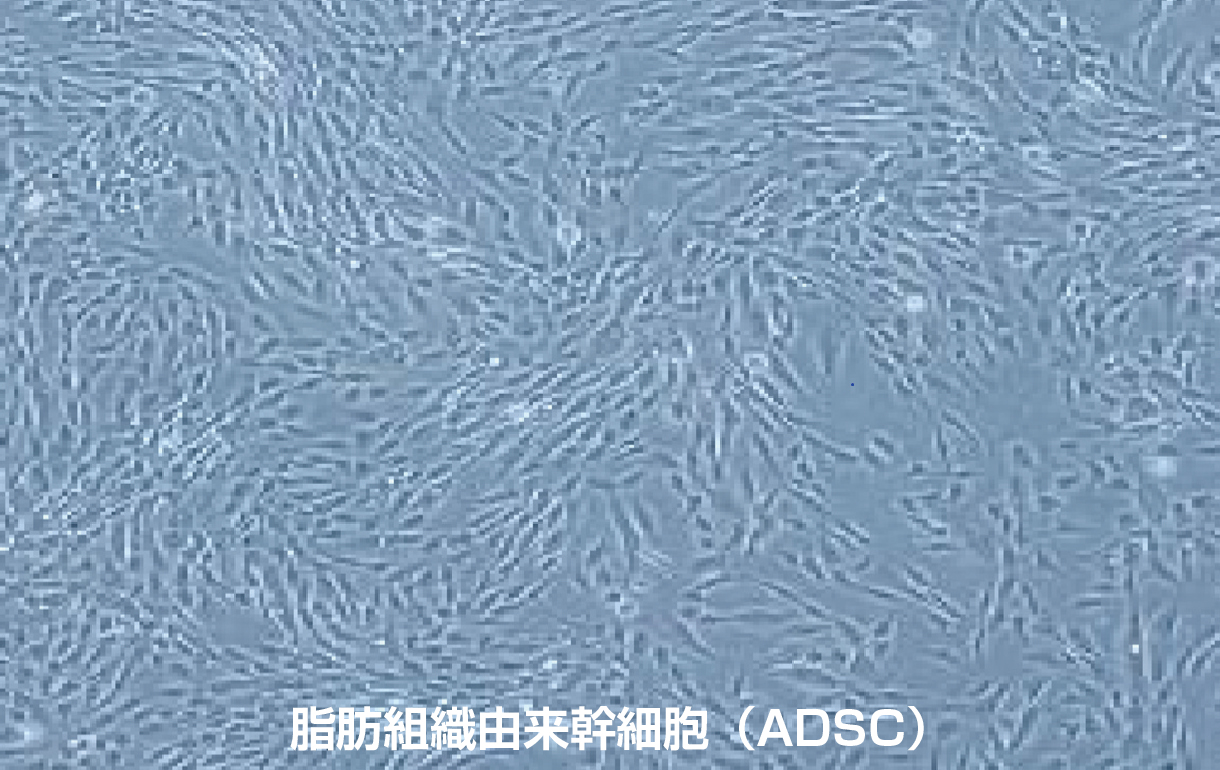 脂肪細胞由来幹細胞(ADSC)